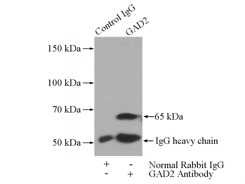 IP Result of anti-GAD2 (IP:Catalog No:110818, 4ug; Detection:Catalog No:110818 1:1000) with mouse brain tissue lysate 3440ug.