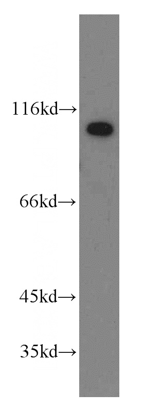 human heart tissue were subjected to SDS PAGE followed by western blot with Catalog No:117053(ZHX2 antibody) at dilution of 1:800