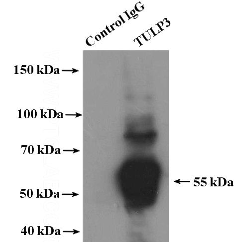 IP Result of anti-TULP3 (IP:Catalog No:116493, 4ug; Detection:Catalog No:116493 1:800) with SH-SY5Y cells lysate 1600ug.