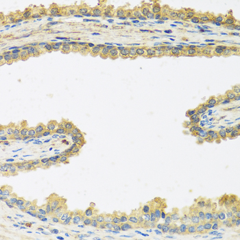Immunohistochemistry - CRHBP Polyclonal Antibody 