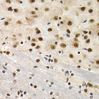 Immunohistochemistry - ID3 Polyclonal Antibody 