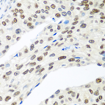 Immunohistochemistry - MDC1 Polyclonal Antibody 