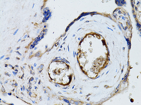 Immunohistochemistry - RYR2 Polyclonal Antibody 