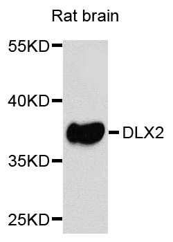 Western blot - DLX2 Polyclonal Antibody 