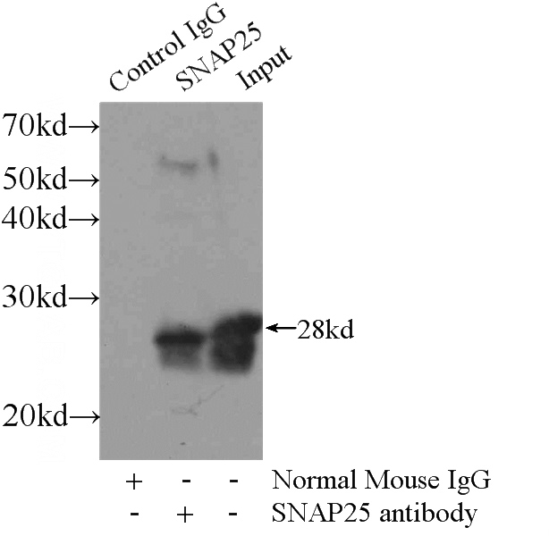 IP Result of anti-SNAP (IP:Catalog No:107597, 3ug; Detection:Catalog No:107597 1:500) with mouse brain tissue lysate 3600ug.