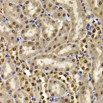 Immunohistochemistry - HIRIP3 Polyclonal Antibody 
