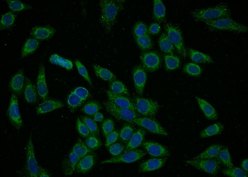 Immunofluorescent analysis of HeLa cells using Catalog No:114359(PYGL Antibody) at dilution of 1:50 and Alexa Fluor 488-congugated AffiniPure Goat Anti-Rabbit IgG(H+L)