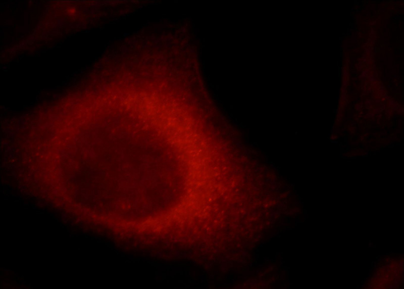 Immunofluorescent analysis of HepG2 cells, using CYP26B1 antibody Catalog No:109688 at 1:25 dilution and Rhodamine-labeled goat anti-rabbit IgG (red).