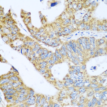 Immunohistochemistry - GLUD1 Polyclonal Antibody 