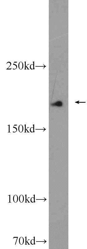 human blood tissue were subjected to SDS PAGE followed by western blot with Catalog No:107877(A2M antibody) at dilution of 1:6000