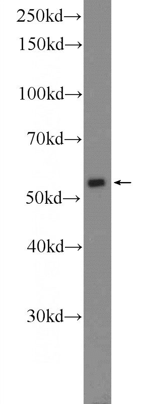 COLO 320 cells were subjected to SDS PAGE followed by western blot with Catalog No:114002(POLG2 Antibody) at dilution of 1:1000