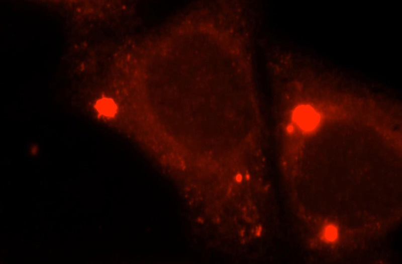 Immunofluorescent analysis of HepG2 cells, using ACOX2 antibody Catalog No:107750 at 1:25 dilution and Rhodamine-labeled goat anti-rabbit IgG (red).