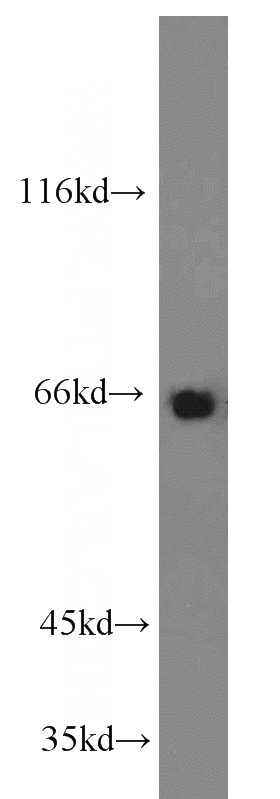 L02 cells were subjected to SDS PAGE followed by western blot with Catalog No:114274(PTH2R antibody) at dilution of 1:500