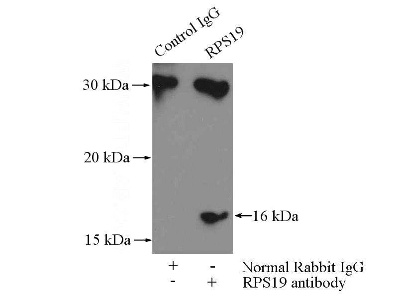 IP Result of anti-RPS19 (IP:Catalog No:114832, 4ug; Detection:Catalog No:114832 1:500) with HEK-293 cells lysate 880ug.