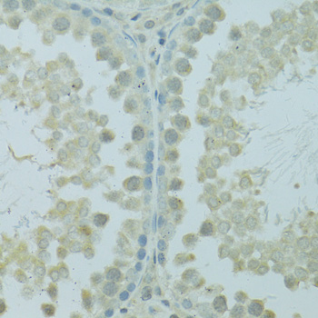 Immunohistochemistry - HUS1B Polyclonal Antibody 