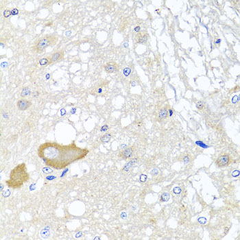 Immunohistochemistry - MCCC2 Polyclonal Antibody 