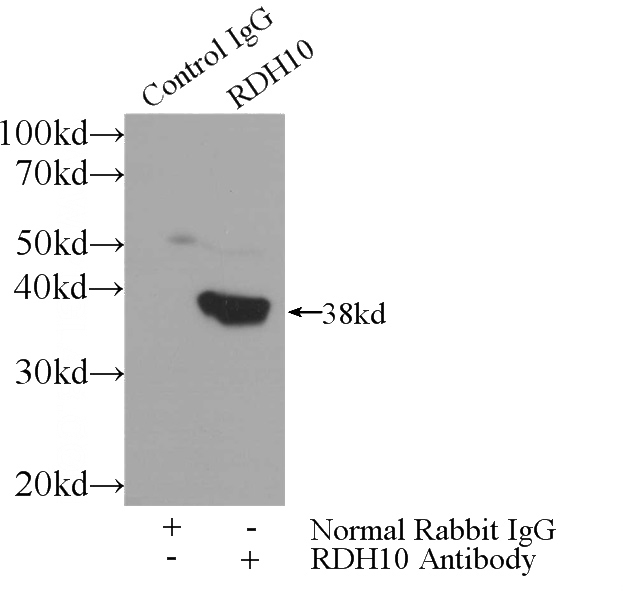 IP Result of anti-RDH10 (IP:Catalog No:114583, 3ug; Detection:Catalog No:114583 1:700) with mouse liver tissue lysate 4000ug.