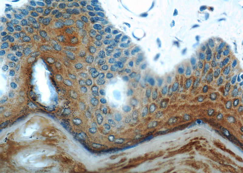 Immunohistochemical of paraffin-embedded human skin using Catalog No:109804(KRT1-specific antibody) at dilution of 1:100 (under 40x lens)