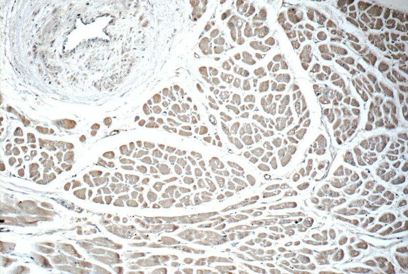 Immunohistochemistry of paraffin-embedded human heart tissue slide using Catalog No:110297(EDA Antibody) at dilution of 1:50 (under 10x lens)