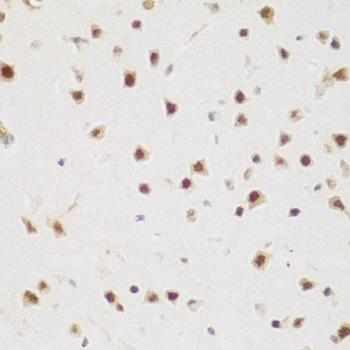 Immunohistochemistry - BRD9 Polyclonal Antibody 