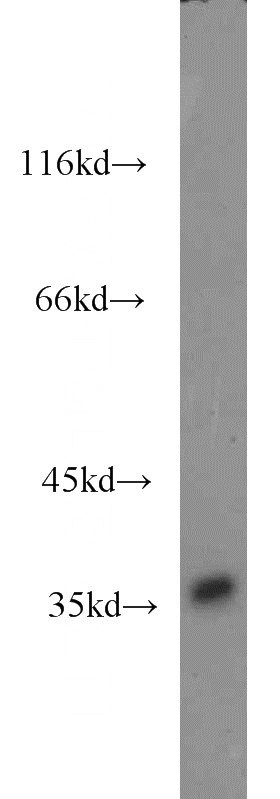 human brain tissue were subjected to SDS PAGE followed by western blot with Catalog No:117164(ZNF346 antibody) at dilution of 1:2000