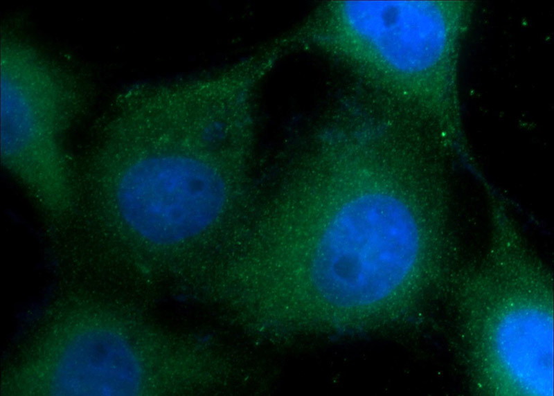 Immunofluorescent analysis of A431 cells using Catalog No:109804(KRT1-specific Antibody) at dilution of 1:50 and Alexa Fluor 488-congugated AffiniPure Goat Anti-Rabbit IgG(H+L)