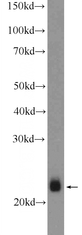 mouse skeletal muscle tissue were subjected to SDS PAGE followed by western blot with Catalog No:114862(RTN2 Antibody) at dilution of 1:1000
