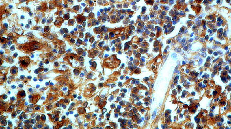 Immunohistochemical of paraffin-embedded human spleen using Catalog No:115212(APCS antibody) at dilution of 1:50 (under 40x lens)