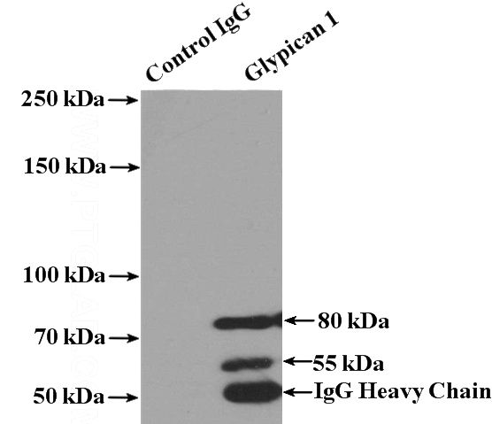 IP Result of anti-GPC1 (IP:Catalog No:111087, 4ug; Detection:Catalog No:111087 1:500) with BxPC-3 cells lysate 2800ug.