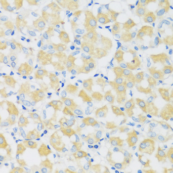 Immunohistochemistry - C1GALT1 Polyclonal Antibody 