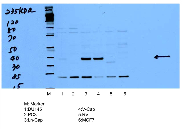 WB result of Catalog No:107987(anti-P504S,AMACR) from Dr. Soory.