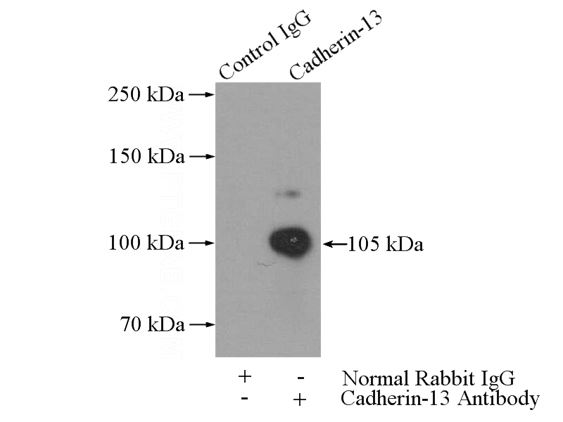 IP Result of anti-CDH13 (IP:Catalog No:108772, 4ug; Detection:Catalog No:108772 1:700) with mouse heart tissue lysate 4000ug.