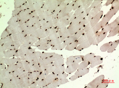 Fig2:; Immunohistochemical analysis of paraffin-embedded human-muscle, antibody was diluted at 1:100