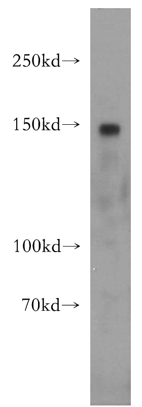 NIH/3T3 cells were subjected to SDS PAGE followed by western blot with Catalog No:109203(CGNL1 antibody) at dilution of 1:2000