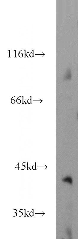 mouse brain tissue were subjected to SDS PAGE followed by western blot with Catalog No:111102(GMPPB antibody) at dilution of 1:1000