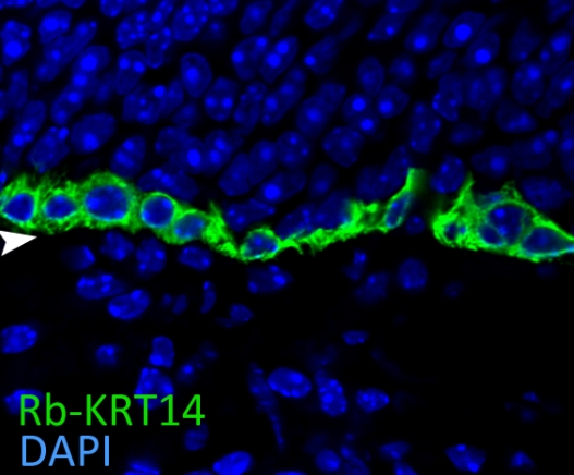IF result of CK14 (Catalog No:109792, 1:400) with 1% PLP fixed basal quiescent stem cells of the adult mouse olfactory epithelium. (Green: CK14; Blue: DAPI). Basal lamina is marked by an arrow head. By Brian Lin, Tufts University.