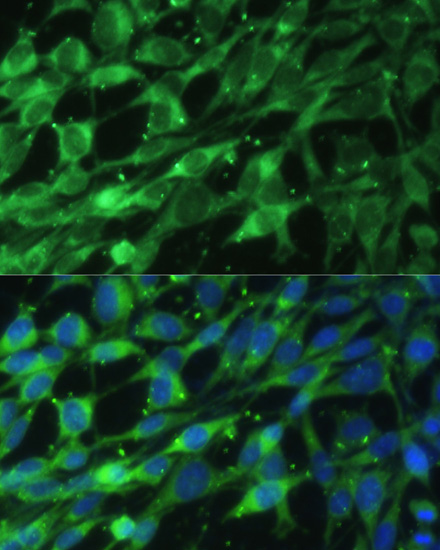 Immunofluorescence - BLOC1S3 Polyclonal Antibody 