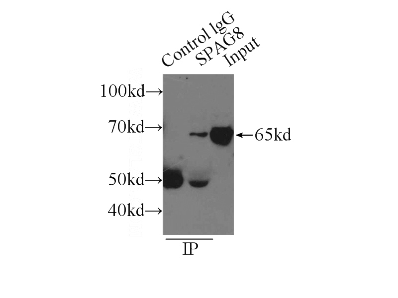 IP Result of anti-SPAG8 (IP:Catalog No:115536, 3ug; Detection:Catalog No:115536 1:500) with mouse testis tissue lysate 6000ug.