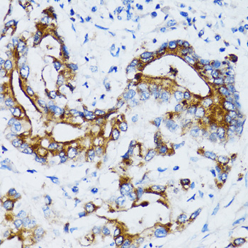 Immunohistochemistry - MMP7 Polyclonal Antibody 