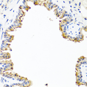 Immunohistochemistry - COL10A1 Polyclonal Antibody 