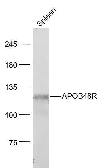 Fig2: Sample:; Spleen (Mouse) Lysate at 40 ug; Primary: Anti- APOB48R at 1/1000 dilution; Secondary: IRDye800CW Goat Anti-Rabbit IgG at 1/20000 dilution; Predicted band size: 115 kD; Observed band size: 115 kD