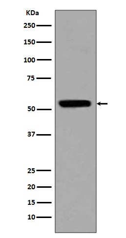 Western blot analysis of p53 (acetyl K370) expression in HeLa cell lysate treated with Trichostatin A.