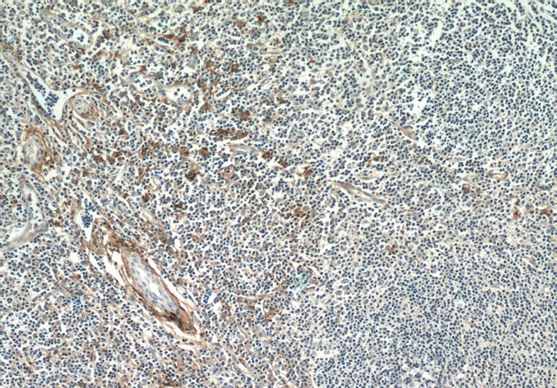 Immunohistochemistry of paraffin-embedded human tonsillitis tissue slide using (ANPEP Antibody) at dilution of 1:100 (under 10x lens)