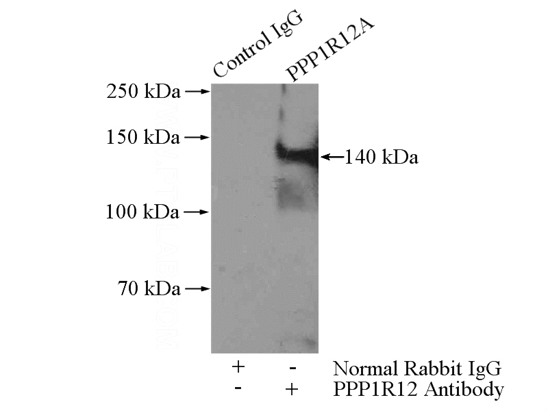 IP Result of anti-MYPT1 (IP:Catalog No:113001, 4ug; Detection:Catalog No:113001 1:500) with HEK-293 cells lysate 1200ug.