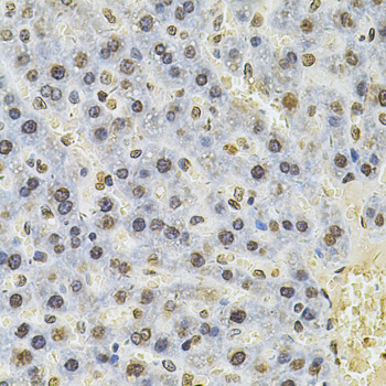 Immunohistochemistry - PSMC3 Polyclonal Antibody 