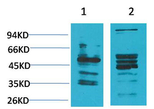 Fig1:; Western blot analysis of 1) Human Brain Tissue, 2) Rat Brain Tissue using NMBR Polyclonal Antibody.. Secondary antibody（catalog#: HA1001) was diluted at 1:20000