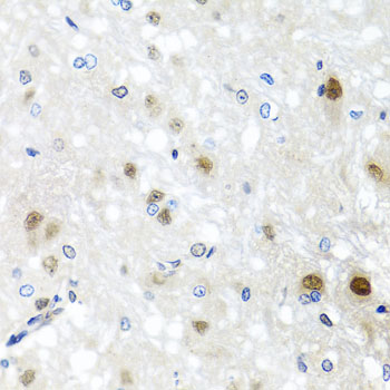 Immunohistochemistry - SAFB2 Polyclonal Antibody 