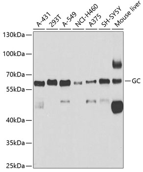 Western blot - GC Polyclonal Antibody 