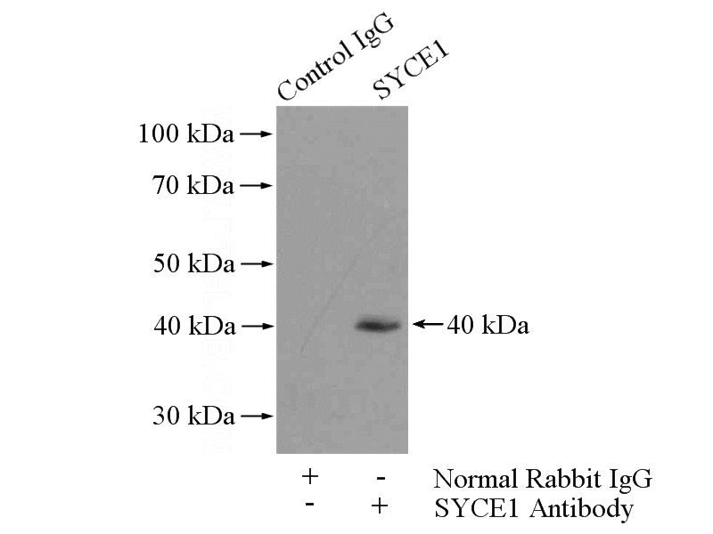 IP Result of anti-SYCE1 (IP:Catalog No:115758, 4ug; Detection:Catalog No:115758 1:800) with mouse testis tissue lysate 4800ug.