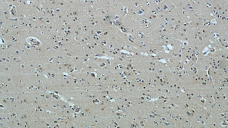 Immunohistochemical of paraffin-embedded human brain using Catalog No:113120(NeuN antibody) at dilution of 1:50 (under 10x lens)